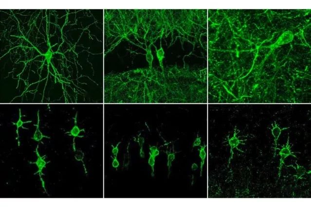 MIT新技术：一根探针成像多个神经元，让神经元放电“看得见”